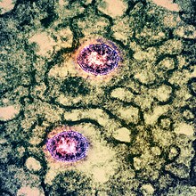 False-color transmission electron micrograph of an Omicron variant coronavirus, shown in pink, replicating within the cytoplasm of an infected Vero cell Novel Coronavirus SARS-CoV-2 (Omicron) (52228029552).jpg