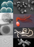 צילומים מיקרוסקופיים של מיני ארכיאה שונים בשיטות צביעה שונות