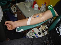 Typical method of blood donation