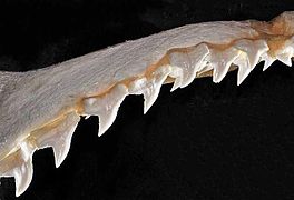 Upper teeth