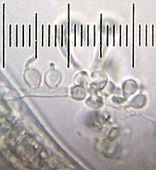 A closer look at H. anguillulae from the previous image. Numbered ticks are 20 mm apart. 20100814 180201 FungusOnDeadnematode HarposporiumAnguillulae.jpg