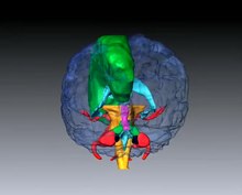 Файл: Области головного мозга, снабжаемые передней мозговой артерией.webm