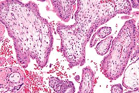 Chorionic villi - high mag.jpg