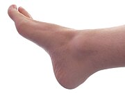 http://upload.wikimedia.org/wikipedia/commons/thumb/a/ae/Male_Right_Foot_1.jpg/180px-Male_Right_Foot_1.jpg