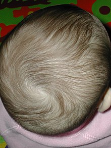 Thin brown hair of a one-year-old infant girl Baby hairy head DSCN2483.jpg