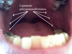 Bouche ouverte. Ligaments ptérygomandibulaires indiqués avec des flèches. Attention, les dents de sagesse inférieures ont été enlevées, changeant un peu la forme des ligaments ptérygomandibulaires, qui habituellement se courbent près de leurs terminaisons inférieures, autour des dents de sagesse inférieures, en se rattachant au mandibule antérieurement à celles-ci.