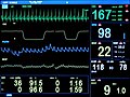 Vorschaubild der Version vom 21:53, 10. Feb. 2012