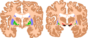 Basal ganglia.png