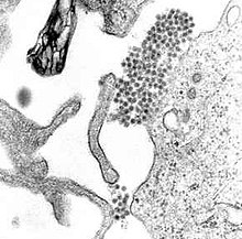 डेंगू वायरस दिखाती एक संचरण इलेक्ट्रॉन माइक्रोस्कोप छवि