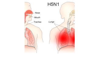 English: Different sites and outcomes of H1N1 ...