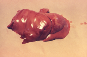 Неизвестен животински черен дроб, показващ черни некротични петна от инфекция с лептоспироза