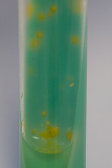 Mycobacterium kansasii, растущие на среде Левенштейна – Йенсена.jpg