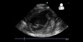 File:UOTW 29 - Ultrasound of the Week 2.webm