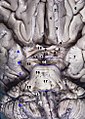 Brain and brainstem seen from below