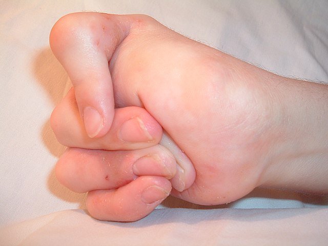 Thumb image