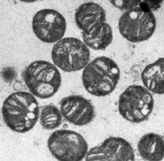 Methylococcus capsulatus, мікрофотографія за допомогою ТЕМ