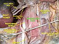 Inferior vena cava