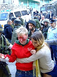 Swedish volunteer Tove Johannson (pictured) suffered a broken cheekbone from a hit in the face with a bottle by an Israeli settler in Hebron on November 18, 2006. She and other European members of the International Solidarity Movement sought to escort Palestinian children home from school. Bloodied-face-sm.JPG