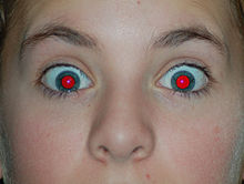 Red Eye Picture