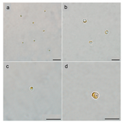 LM-Aufnahmen von A. anophagefferens Stamm CCMP1984: RSC und vegetative Zellen (VCs); Balken 10 µm.[1]