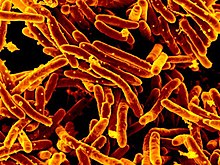 Mycobacterium tuberculosis MEB (1) .jpg