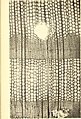 Image 22A thin transverse section showing the internal structure of conifer wood (from Conifer)