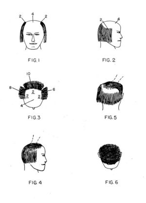 This variant of the comb over was patented in ...