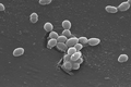 Enterococcus faecalis 双球菌