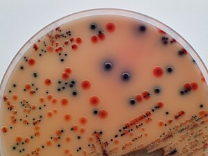 Isolation of Salmonella and E. coli on medium ...