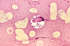 Leishmania donovani в клетке костного мозга