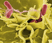 Color-enhanced scanning electron micrograph of red Salmonella typhimurium in yellow human cells