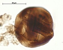 Tetrade de cryptospore (Tetrahedraletes medinensis)