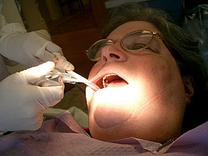 A Dental hygienist attends to a patient.
