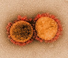 Novel Coronavirus SARS-CoV-2 (49640655138).jpg