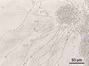 Candida albicans, a dimorphic fungus which grows as a yeast in the gut.