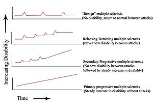 Types of MS