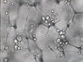Stärkekörner (Amyloplasten) in situ in Speicherzellen der Kartoffelknolle