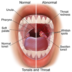 Anatomy of the tonsils and throat.