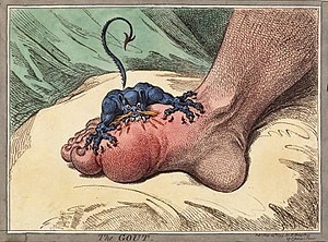 The Gout by James Gillray. Published May 14th ...