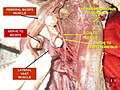 Femoral biceps muscle