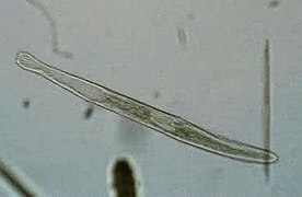 Spirostomum teres (Spirostomidae)