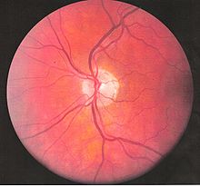 Кровеносные сосуды левого глаза