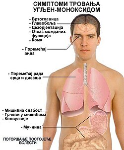 Симптоми тровања угљен-моноксидом по системима органа