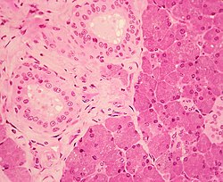 WVSOM Parotid Gland1.JPG