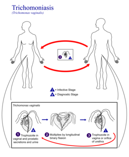 Description de l'image Trichomoniasis 01.png.