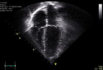 An echocardiogram.  Image shows that the human...