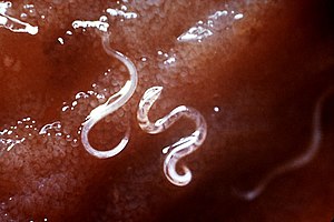 Ancylostoma caninum, a type of hookworm, attac...