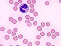 Miniatura para Mycoplasma felis