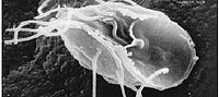 Giardia lamblia, parazitska diplomonada