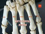 Metacarpal bones.